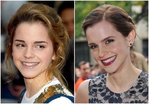 欧美明星牙齿,牙齿护理与美容秘诀大揭秘